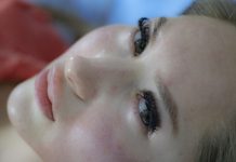 ลดรอยสิว ด้วยวิธีธรรมชาติ ทำง่ายๆ ได้ผลจริง ลดรอยสิว