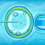 IUI คืออะไร?